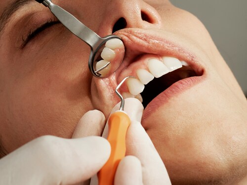 Important Things to Consider When Choosing a Cerec Dentist